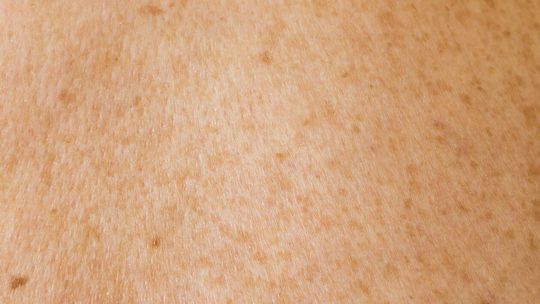  dr hab. n. med. Joanna Bartosińska