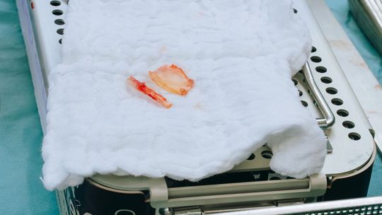 Nowatorska operacja w USK 4