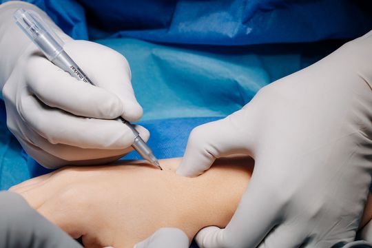 Operacja nadgarstka w USK 4