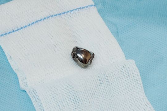 Operacja nadgarstka w USK 4