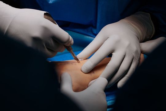 Operacja nadgarstka w USK 4