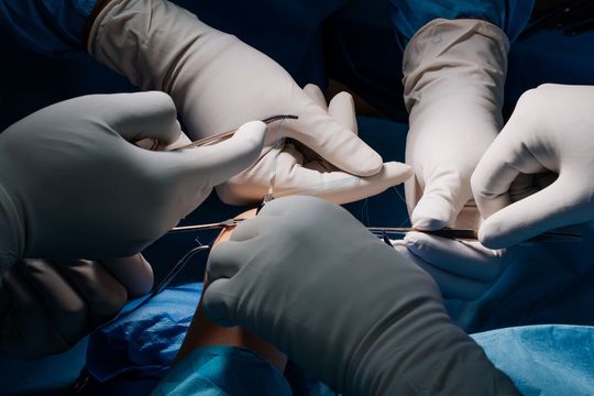 Operacja nadgarstka w USK 4