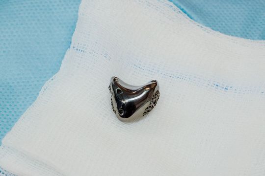 Operacja nadgarstka w USK 4